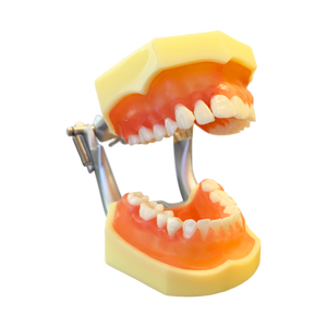 Model boală parodontală cu dinţi detaşabili cu şurub - 4022