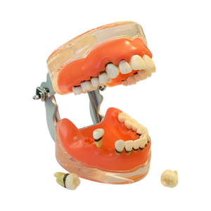 Model boală parodontală cu dinţi detaşabili pe cadranul 4 - 4017